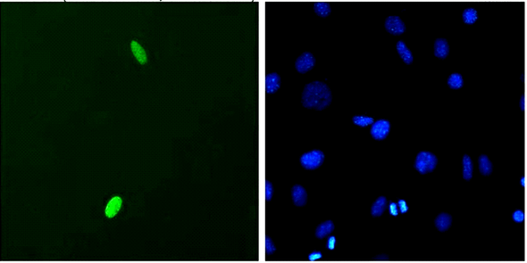 Immunocytochemistry/Immunofluorescence analysis using Mouse Anti-DUX4 Monoclonal Antibody, Clone P2B1 (STMA00052). Tissue: C2C12 myoblast cells. Species: Mouse. Primary Antibody: Mouse Anti-DUX4 Monoclonal Antibody (STMA00052) at 1:1000. Secondary Antibody: FITC Goat Anti-Mouse (green). Counterstain: DAPI (blue) nuclear stain. Cells transfected with pCS2+DUX4.