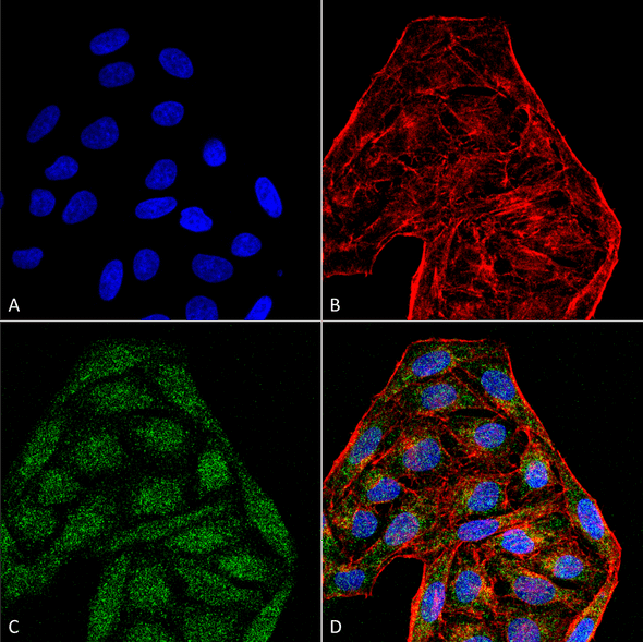 Immunocytochemistry/Immunofluorescence analysis using Mouse Anti-CD74 Monoclonal Antibody, Clone 6D9 (STMA00079). Tissue: Cervical cancer cell line (HeLa). Species: Human. Fixation: 4% Formaldehyde for 15 min at RT. Primary Antibody: Mouse Anti-CD74 Monoclonal Antibody (STMA00079) at 1:100 for 60 min at RT. Secondary Antibody: Goat Anti-Mouse ATTO 488 at 1:200 for 60 min at RT.
