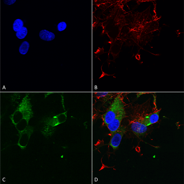 Immunocytochemistry/Immunofluorescence analysis using Mouse Anti-Cav1.3 Monoclonal Antibody, Clone S48 (STMA00081). Tissue: Neuroblastoma cells (SH-SY5Y). Species: Human. Fixation: 4% PFA for 15 min. Primary Antibody: Mouse Anti-Cav1.3 Monoclonal Antibody (STMA00081) at 1:50 for overnight at 4°C with slow rocking. Secondary Antibody: AlexaFluor 488 at 1:1000 for 1 hour at RT.