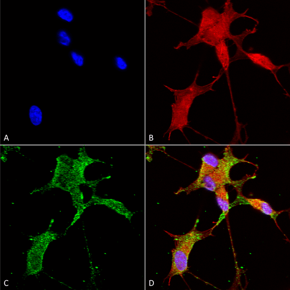 Immunocytochemistry/Immunofluorescence analysis using Mouse Anti-Cav3.2 Monoclonal Antibody, Clone N55/10 (STMA00082). Tissue: Neuroblastoma cells (SH-SY5Y). Species: Human. Fixation: 4% PFA for 15 min. Primary Antibody: Mouse Anti-Cav3.2 Monoclonal Antibody (STMA00082) at 1:50 for overnight at 4°C with slow rocking. Secondary Antibody: AlexaFluor 488 at 1:1000 for 1 hour at RT.