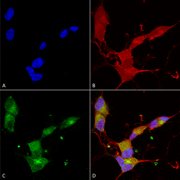 Immunocytochemistry/Immunofluorescence analysis using Mouse Anti-KCNQ4 Monoclonal Antibody, Clone N43/6 (STMA00086). Tissue: Neuroblastoma cells (SH-SY5Y). Species: Human. Fixation: 4% PFA for 15 min. Primary Antibody: Mouse Anti-KCNQ4 Monoclonal Antibody (STMA00086) at 1:100 for overnight at 4°C with slow rocking. Secondary Antibody: AlexaFluor 488 at 1:1000 for 1 hour at RT.