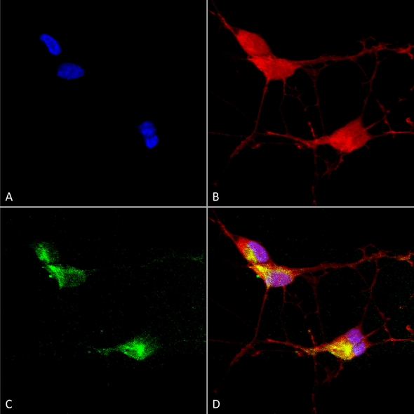 Immunocytochemistry/Immunofluorescence analysis using Mouse Anti-TrpV3 Monoclonal Antibody, Clone N15/4 (STMA00090). Tissue: Neuroblastoma cells (SH-SY5Y). Species: Human. Fixation: 4% PFA for 15 min. Primary Antibody: Mouse Anti-TrpV3 Monoclonal Antibody (STMA00090) at 1:100 for overnight at 4°C with slow rocking. Secondary Antibody: AlexaFluor 488 at 1:1000 for 1 hour at RT.