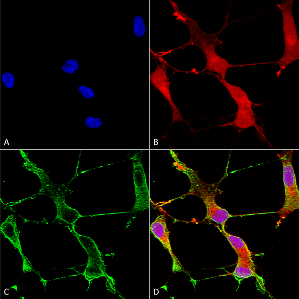 Immunocytochemistry/Immunofluorescence analysis using Mouse Anti-SHANK1 Monoclonal Antibody, Clone S22-21 (STMA00094). Tissue: Neuroblastoma cells (SH-SY5Y). Species: Human. Fixation: 4% PFA for 15 min. Primary Antibody: Mouse Anti-SHANK1 Monoclonal Antibody (STMA00094) at 1:50 for overnight at 4°C with slow rocking. Secondary Antibody: AlexaFluor 488 at 1:1000 for 1 hour at RT.