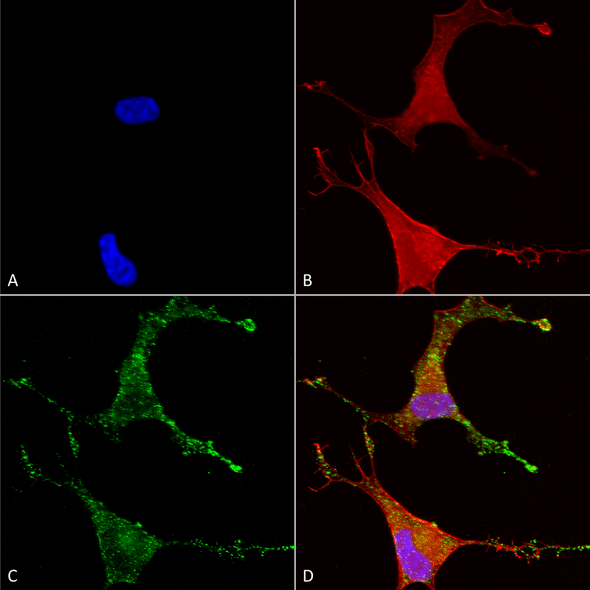 Immunocytochemistry/Immunofluorescence analysis using Mouse Anti-Cav beta 2 Monoclonal Antibody, Clone S8B-1 (STMA00095). Tissue: Neuroblastoma cells (SH-SY5Y). Species: Human. Fixation: 4% PFA for 15 min. Primary Antibody: Mouse Anti-Cav beta 2 Monoclonal Antibody (STMA00095) at 1:50 for overnight at 4°C with slow rocking. Secondary Antibody: AlexaFluor 488 at 1:1000 for 1 hour at RT.