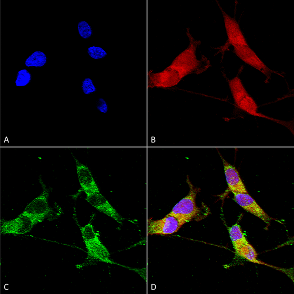 Immunocytochemistry/Immunofluorescence analysis using Mouse Anti-VGLUT2 Monoclonal Antibody, Clone N29/29 (STMA00110). Tissue: Neuroblastoma cells (SH-SY5Y). Species: Human. Fixation: 4% PFA for 15 min. Primary Antibody: Mouse Anti-VGLUT2 Monoclonal Antibody (STMA00110) at 1:50 for overnight at 4°C with slow rocking. Secondary Antibody: AlexaFluor 488 at 1:1000 for 1 hour at RT.