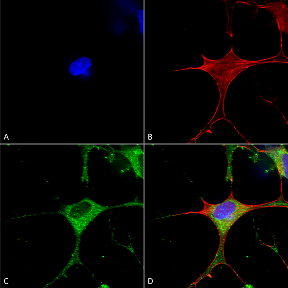 Immunocytochemistry/Immunofluorescence analysis using Mouse Anti-Clcn3 Monoclonal Antibody, Clone N258/5 (STMA00122). Tissue: Neuroblastoma cells (SH-SY5Y). Species: Human. Fixation: 4% PFA for 15 min. Primary Antibody: Mouse Anti-Clcn3 Monoclonal Antibody (STMA00122) at 1:50 for overnight at 4°C with slow rocking. Secondary Antibody: AlexaFluor 488 at 1:1000 for 1 hour at RT.