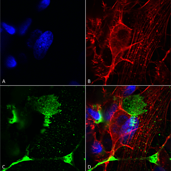 Immunocytochemistry/Immunofluorescence analysis using Mouse Anti-LRP4 (Extracellular) Monoclonal Antibody, Clone N207/27 (STMA00128). Tissue: Neuroblastoma cells (SH-SY5Y). Species: Human. Fixation: 4% PFA for 15 min. Primary Antibody: Mouse Anti-LRP4 (Extracellular) Monoclonal Antibody (STMA00128) at 1:200 for overnight at 4°C with slow rocking. Secondary Antibody: AlexaFluor 488 at 1:1000 for 1 hour at RT.