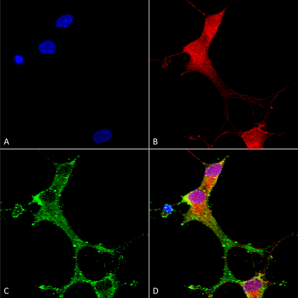 Immunocytochemistry/Immunofluorescence analysis using Mouse Anti-mGluR1/5 Monoclonal Antibody, Clone N75/3 (STMA00129). Tissue: Neuroblastoma cells (SH-SY5Y). Species: Human. Fixation: 4% PFA for 15 min. Primary Antibody: Mouse Anti-mGluR1/5 Monoclonal Antibody (STMA00129) at 1:50 for overnight at 4°C with slow rocking. Secondary Antibody: AlexaFluor 488 at 1:1000 for 1 hour at RT.