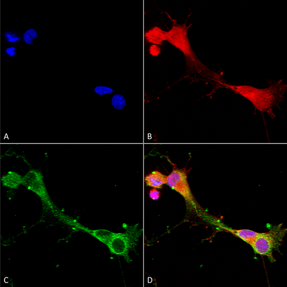 Immunocytochemistry/Immunofluorescence analysis using Mouse Anti-ASIC1 Monoclonal Antibody, Clone N271/44 (STMA00132). Tissue: Neuroblastoma cells (SH-SY5Y). Species: Human. Fixation: 4% PFA for 15 min. Primary Antibody: Mouse Anti-ASIC1 Monoclonal Antibody (STMA00132) at 1:100 for overnight at 4°C with slow rocking. Secondary Antibody: AlexaFluor 488 at 1:1000 for 1 hour at RT.