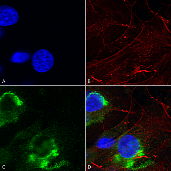 Immunocytochemistry/Immunofluorescence analysis using Mouse Anti-GFAP R416WT Monoclonal Antibody, Clone N206B/9 (STMA00142). Tissue: Neuroblastoma cells (SH-SY5Y). Species: Human. Fixation: 4% PFA for 15 min. Primary Antibody: Mouse Anti-GFAP R416WT Monoclonal Antibody (STMA00142) at 1:200 for overnight at 4°C with slow rocking. Secondary Antibody: AlexaFluor 488 at 1:1000 for 1 hour at RT.