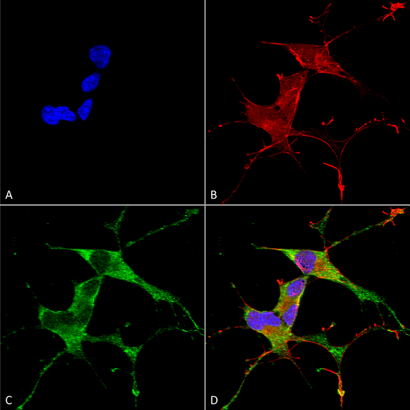Immunocytochemistry/Immunofluorescence analysis using Mouse Anti-LRRK2/Dardarin Monoclonal Antibody, Clone N231B/34 (STMA00144). Tissue: Neuroblastoma cells (SH-SY5Y). Species: Human. Fixation: 4% PFA for 15 min. Primary Antibody: Mouse Anti-LRRK2/Dardarin Monoclonal Antibody (STMA00144) at 1:100 for overnight at 4°C with slow rocking. Secondary Antibody: AlexaFluor 488 at 1:1000 for 1 hour at RT.