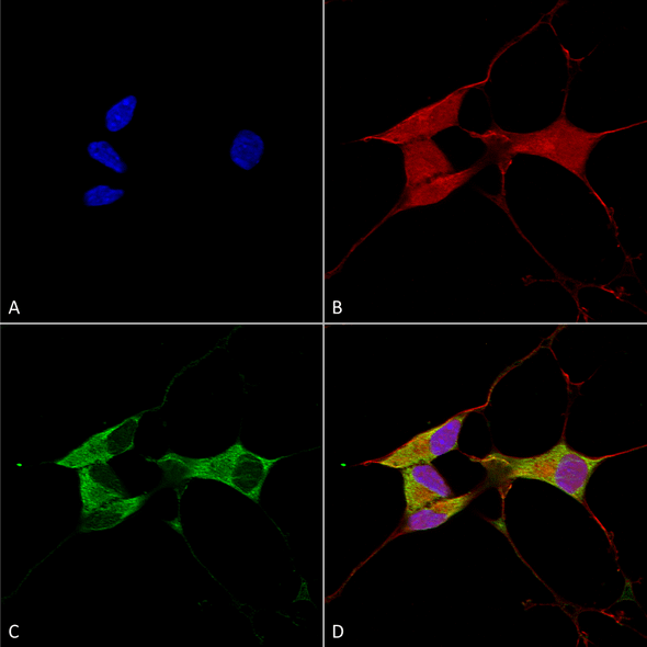 Immunocytochemistry/Immunofluorescence analysis using Mouse Anti-Mitofusin 2 Monoclonal Antibody, Clone N153/5 (STMA00152). Tissue: Neuroblastoma cells (SH-SY5Y). Species: Human. Fixation: 4% PFA for 15 min. Primary Antibody: Mouse Anti-Mitofusin 2 Monoclonal Antibody (STMA00152) at 1:100 for overnight at 4°C with slow rocking. Secondary Antibody: AlexaFluor 488 at 1:1000 for 1 hour at RT.