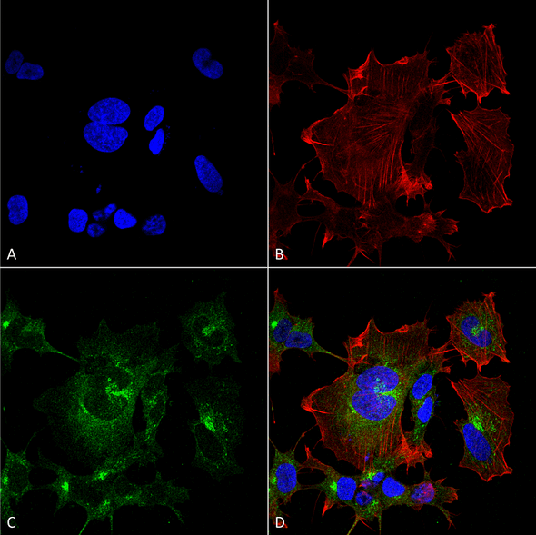 Immunocytochemistry/Immunofluorescence analysis using Mouse Anti-NPAS4 Monoclonal Antibody, Clone N408/79 (STMA00172). Tissue: Neuroblastoma cell line (SK-N-BE). Species: Human. Fixation: 4% Formaldehyde for 15 min at RT. Primary Antibody: Mouse Anti-NPAS4 Monoclonal Antibody (STMA00172) at 1:100 for 60 min at RT. Secondary Antibody: Goat Anti-Mouse ATTO 488 at 1:100 for 60 min at RT.