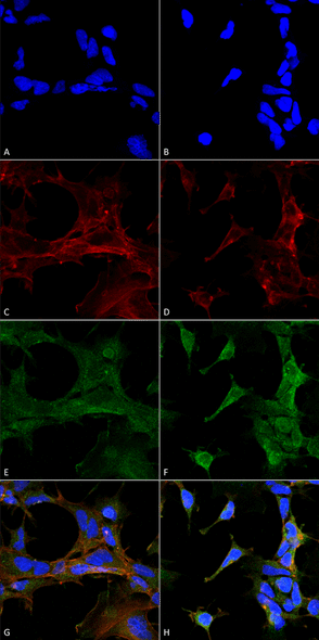 Immunocytochemistry/Immunofluorescence analysis using Mouse Anti-4-Hydroxy-2-hexenal Monoclonal Antibody, Clone 6F10 (STMA00181). Tissue: Embryonic kidney epithelial cell line (HEK293). Species: Human. Fixation: 5% Formaldehyde for 5 min. Primary Antibody: Mouse Anti-4-Hydroxy-2-hexenal Monoclonal Antibody (STMA00181) at 1:400 for 30-60 min at RT. Secondary Antibody: Goat Anti-Mouse Alexa Fluor 488 at 1:1500 for 30-60 min at RT.