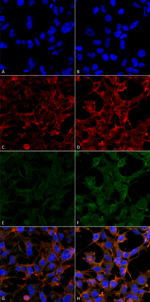 Immunocytochemistry/Immunofluorescence analysis using Mouse Anti-4-Hydroxynonenal Monoclonal Antibody, Clone 12F7 (STMA00182). Tissue: Embryonic kidney epithelial cell line (HEK293). Species: Human. Fixation: 5% Formaldehyde for 5 min. Primary Antibody: Mouse Anti-4-Hydroxynonenal Monoclonal Antibody (STMA00182) at 1:50 for 30-60 min at RT. Secondary Antibody: Goat Anti-Mouse Alexa Fluor 488 at 1:1500 for 30-60 min at RT.