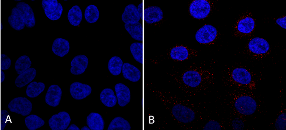 Immunocytochemistry/Immunofluorescence analysis using Mouse Anti-VPS35 Monoclonal Antibody, Clone 7E4 (STMA00208). Tissue: A549 cells. Species: Human. Primary Antibody: Mouse Anti-VPS35 Monoclonal Antibody (STMA00208) at 1:5 (tissue culture supernatant). Secondary Antibody: Donkey anti-mouse: Alexa Fluor 594 at 1:4000 in 0.2% BSA PBS. Counterstain: DAPI. Localization: Vesicles. A) VPS35 KO A549 cells B) WT A549 cells.