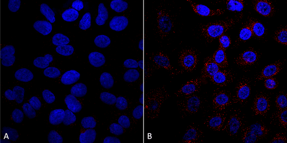 Immunocytochemistry/Immunofluorescence analysis using Mouse Anti-VPS35 Monoclonal Antibody, Clone 5A9 (STMA00209). Tissue: A549 cells. Species: Human. Primary Antibody: Mouse Anti-VPS35 Monoclonal Antibody (STMA00209) at 1:5 (tissue culture supernatant). Secondary Antibody: Donkey anti-mouse: Alexa Fluor 594 at 1:4000 in 0.2% BSA PBS. Counterstain: DAPI. Localization: Vesicles. A) VPS35 KO A549 cells B) WT A549 cells.