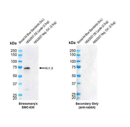 Western blot analysis with Rabbit Anti-Kv1.3 Monoclonal Antibody, Clone CAR1.1 (STMA00234) showing detection of Human Kv1.3 protein in a transient over-expression (OE) lysate (OriGene LY4194581). Block: 2% skim milk + 2% BSA for 1 hour at RT. Primary Antibody: Rabbit Anti-Rat Kv1.3 Recombinant Monoclonal [CAR1.1] (STMA00234) at 1:10,000 for 2 hours at RT. Secondary Antibody: Goat anti-rabbit IgG-HRP (H&L) at 1:5000 for 1 hour at RT.