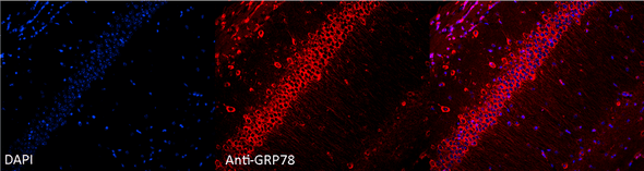 Immunocytochemistry/Immunofluorescence analysis using Rabbit Anti-GRP78 Polyclonal Antibody (STPA00006). Tissue: Hippocampal Section. Species: Mouse. Fixation: 4% Formaldehyde for 12 hours at RT. Paraffin embedded. Primary Antibody: Rabbit Anti-GRP78 Polyclonal Antibody (STPA00006) at 1:100 for 12 hours at 4°C. Secondary Antibody: Alexa Fluor 555 Goat Anti-Rabbit at 1:250 for 1 hour at RT. Counterstain: Hoechst at 1:1000 for 10 min at RT.