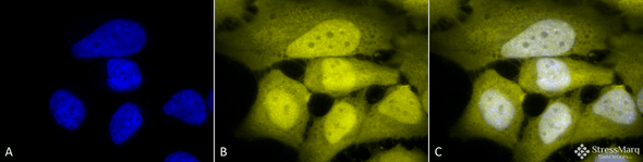 Immunocytochemistry/Immunofluorescence analysis using Rabbit Anti-Phosphoserine Polyclonal Antibody (STPA00021). Tissue: Cervical cancer cell line (HeLa). Species: Human. Fixation: 2% Formaldehyde for 20 min at RT. Primary Antibody: Rabbit Anti-Phosphoserine Polyclonal Antibody (STPA00021) at 1:50 for 12 hours at 4°C. Secondary Antibody: R-PE Goat Anti-Rabbit (yellow) at 1:200 for 2 hours at RT.