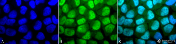Immunocytochemistry/Immunofluorescence analysis using Rabbit Anti-Methylated Lysine Polyclonal Antibody (STPA00024). Tissue: Cervical cancer cell line (HeLa). Species: Human. Fixation: 2% Formaldehyde for 20 min at RT. Primary Antibody: Rabbit Anti-Methylated Lysine Polyclonal Antibody (STPA00024) at 1:50 for 12 hours at 4°C. Secondary Antibody: FITC Goat Anti-Rabbit (green) at 1:200 for 2 hours at RT.