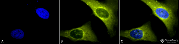 Immunocytochemistry/Immunofluorescence analysis using Rabbit Anti-Rab4 Polyclonal Antibody (STPA00019). Tissue: Heat Shocked Cervical cancer cell line (HeLa). Species: Human. Fixation: 2% Formaldehyde for 20 min at RT. Primary Antibody: Rabbit Anti-Rab4 Polyclonal Antibody (STPA00019) at 1:150 for 12 hours at 4°C. Secondary Antibody: R-PE Goat Anti-Rabbit (yellow) at 1:200 for 2 hours at RT.
