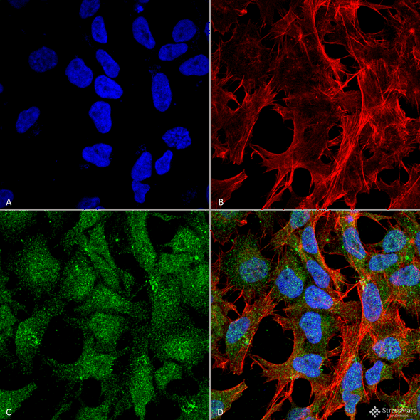 Immunocytochemistry/Immunofluorescence analysis using Rabbit Anti-UVRAG Polyclonal Antibody (STPA00059). Tissue: Neuroblastoma cell line (SK-N-BE). Species: Human. Fixation: 4% Formaldehyde for 15 min at RT. Primary Antibody: Rabbit Anti-UVRAG Polyclonal Antibody (STPA00059) at 1:100 for 60 min at RT. Secondary Antibody: Goat Anti-Rabbit ATTO 488 at 1:100 for 60 min at RT.