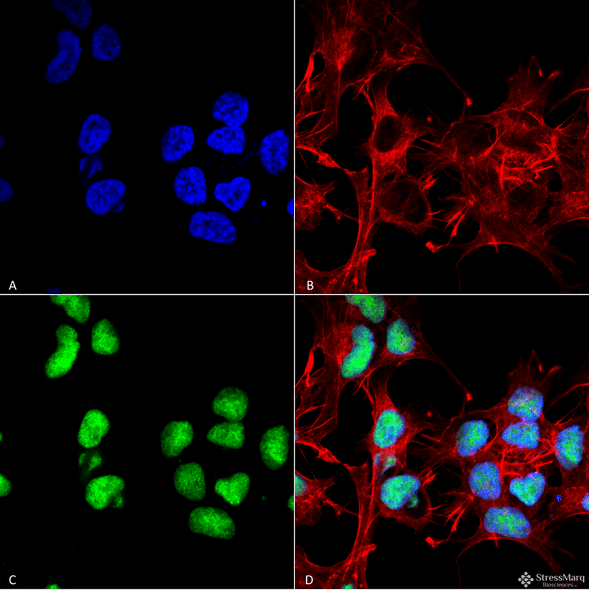 Immunocytochemistry/Immunofluorescence analysis using Rabbit Anti-Choline Acetyltransferase Polyclonal Antibody (STPA00074). Tissue: Neuroblastoma cell line (SK-N-BE). Species: Human. Fixation: 4% Formaldehyde for 15 min at RT. Primary Antibody: Rabbit Anti-Choline Acetyltransferase Polyclonal Antibody (STPA00074) at 1:100 for 60 min at RT. Secondary Antibody: Goat Anti-Rabbit ATTO 488 at 1:100 for 60 min at RT.