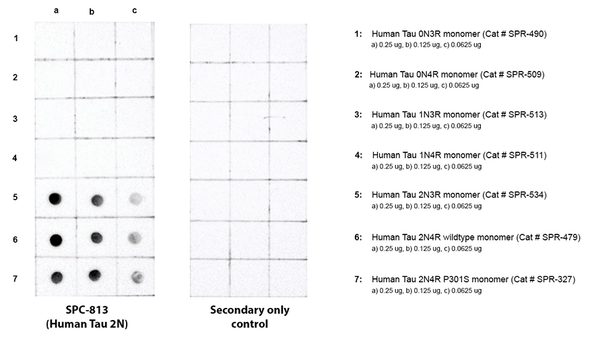 Dot blot analysis comparing detection of Tau isoforms. Of note is that STPA00091 does not bind to 0N or 1N isoforms. Block: 5% skim milk. Primary Antibody: Anti-human Tau 2N3R/4R polyclonal antibody (STPA00091) incubated for 1/2 hour at RT. Secondary Antibody: Goat anti-rabbit IgG:HRP at 1:4000 for 1/2 hour at RT. Color Development: Chemiluminescent for HRP (Moss) for 1 min in RT. Exposed 1 second.