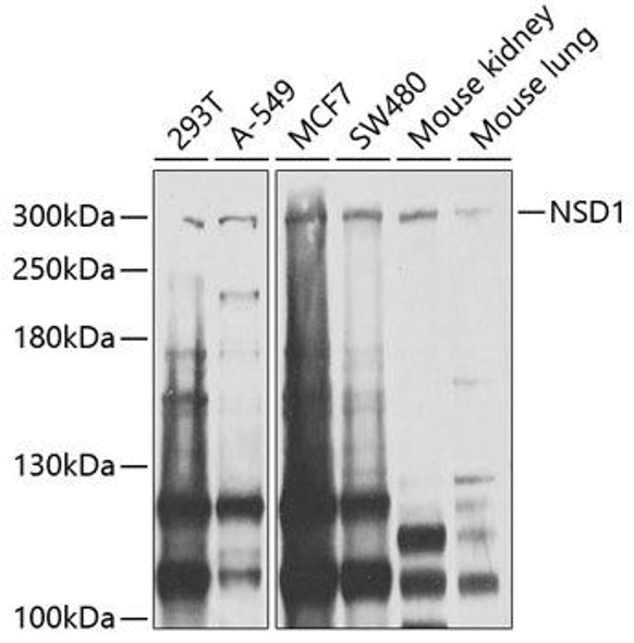 Anti-NSD1 Antibody (CAB9981)