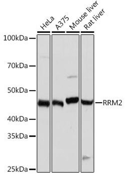 Anti-RRM2 Antibody (CAB3424)