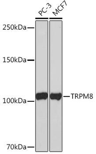 Anti-TRPM8 Antibody (CAB4269)