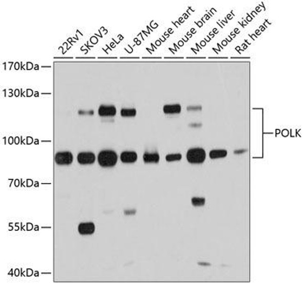 Anti-POLK Antibody (CAB11967)