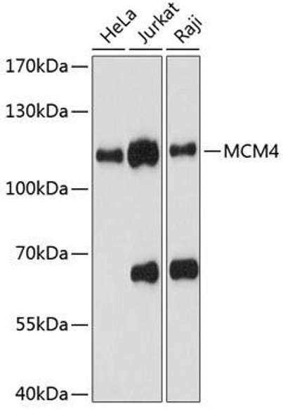 Anti-MCM4 Antibody (CAB13513)