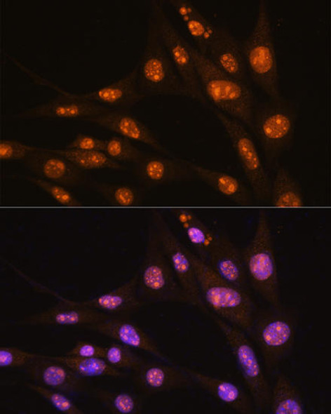 Anti-YY2 Antibody (CAB16621)