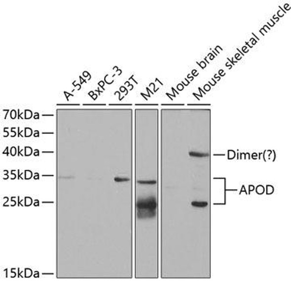 Anti-APOD Antibody (CAB5297)