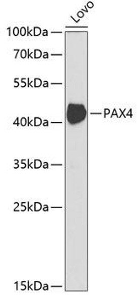 Anti-PAX4 Antibody (CAB5414)