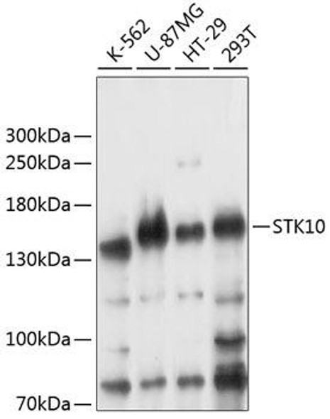 Anti-STK10 Antibody (CAB14257)
