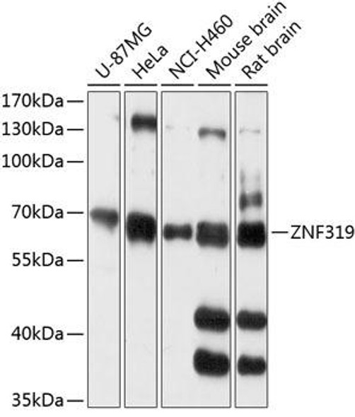 Anti-ZNF319 Antibody (CAB14324)
