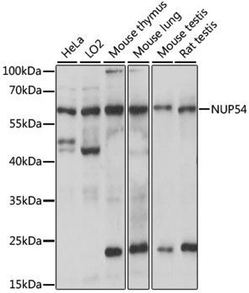 Anti-NUP54 Antibody (CAB15454)