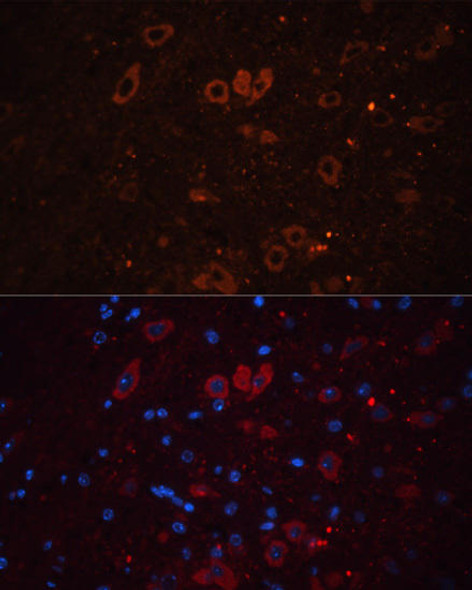 Anti-SLC17A7 Antibody (CAB17188)