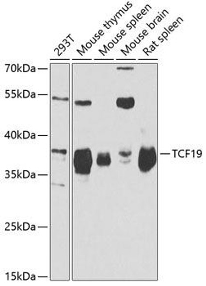 Anti-TCF19 Antibody (CAB6147)