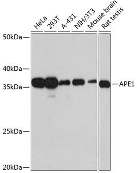 Anti-APE1 Antibody (CAB11238)