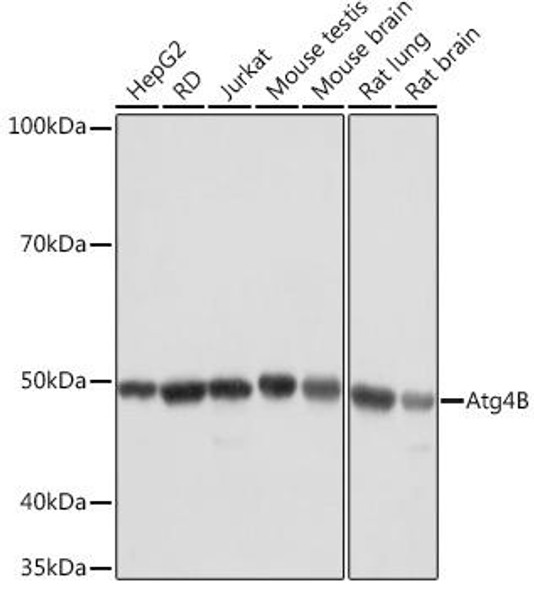 Anti-ATG4B Antibody (CAB5059)