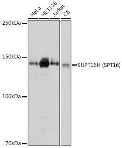 Anti-SUPT16H (SPT16) Antibody (CAB18696)