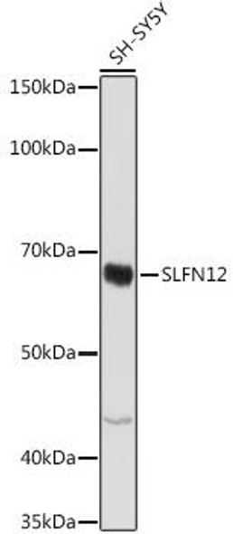 Anti-SLFN12 Antibody (CAB20166)