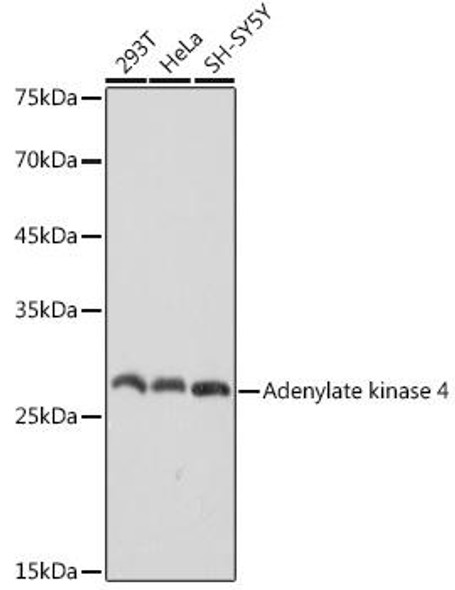 Anti-Adenylate kinase 4 Antibody (CAB2383)