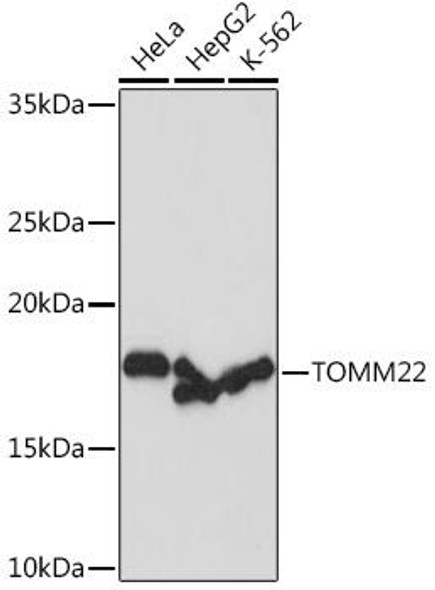 Anti-TOMM22 Antibody (CAB9666)