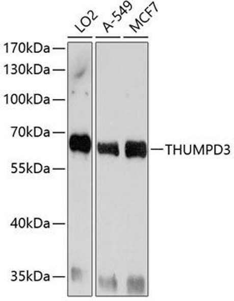 Anti-THUMPD3 Antibody (CAB10407)