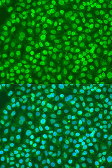 Anti-BDNF Antibody (CAB1307)